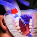 Higiena stomatologiczna w Warszawie