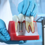 Inżynieria w medycynie – poznaj kierunek studiów!